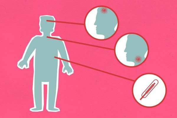 measles symptoms in babies