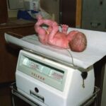 newborn weight loss first week